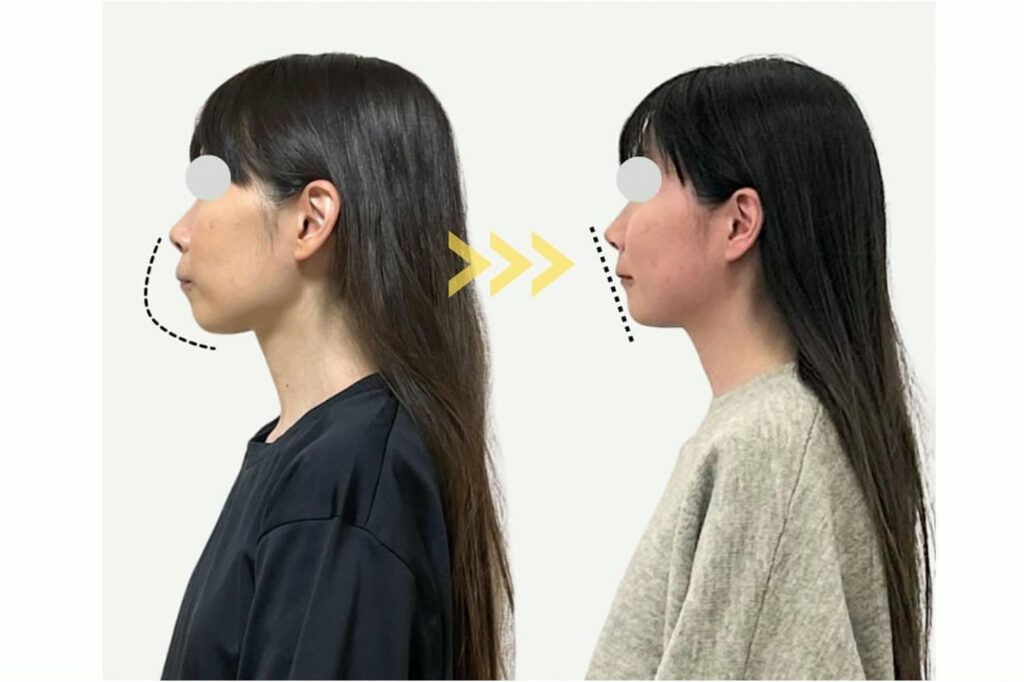 施術の前と後