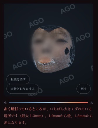 3D診断