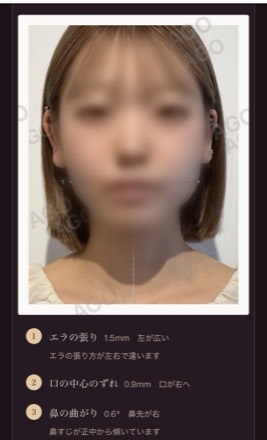 ゆがみの場所